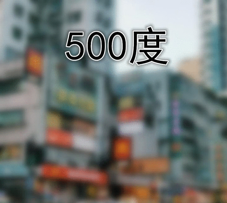 16岁眼睛近视500度图片