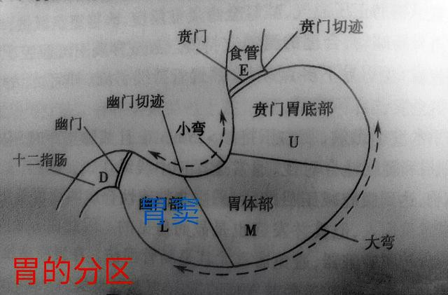 正常胃窦清晰大图图片