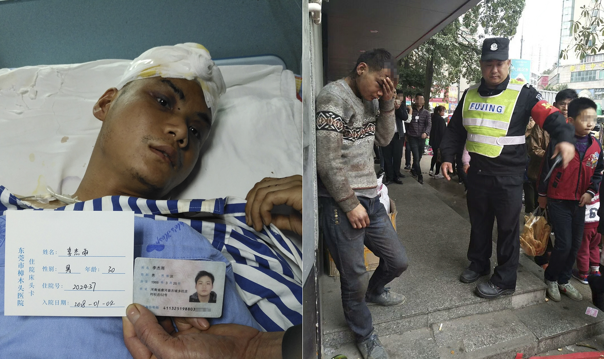 男子头部出现大洞流浪街头,醒来失忆真相成谜