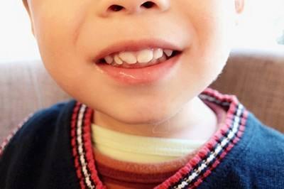 如何让孩子顺利的度过长牙期,多吃这个粮食牙齿整齐又好看