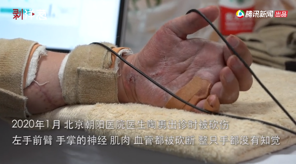 陶勇医生被砍100天后:"如果时光倒流,不会再为他治病"