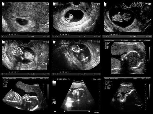 怀孕1一9月宝宝变化图图片