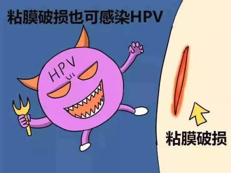 hpv是什么病卡通图片