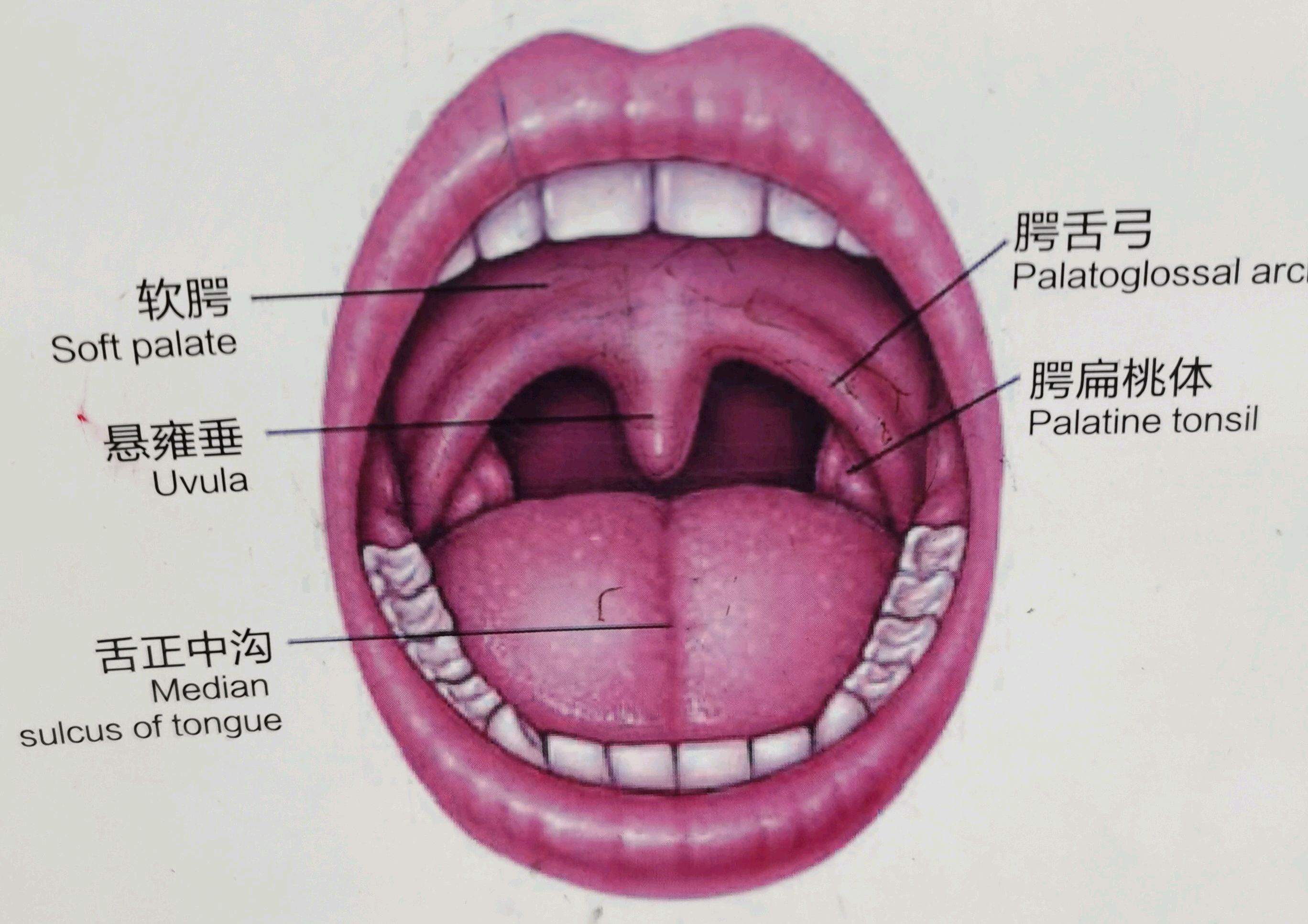 腭弓咽扁桃体图片