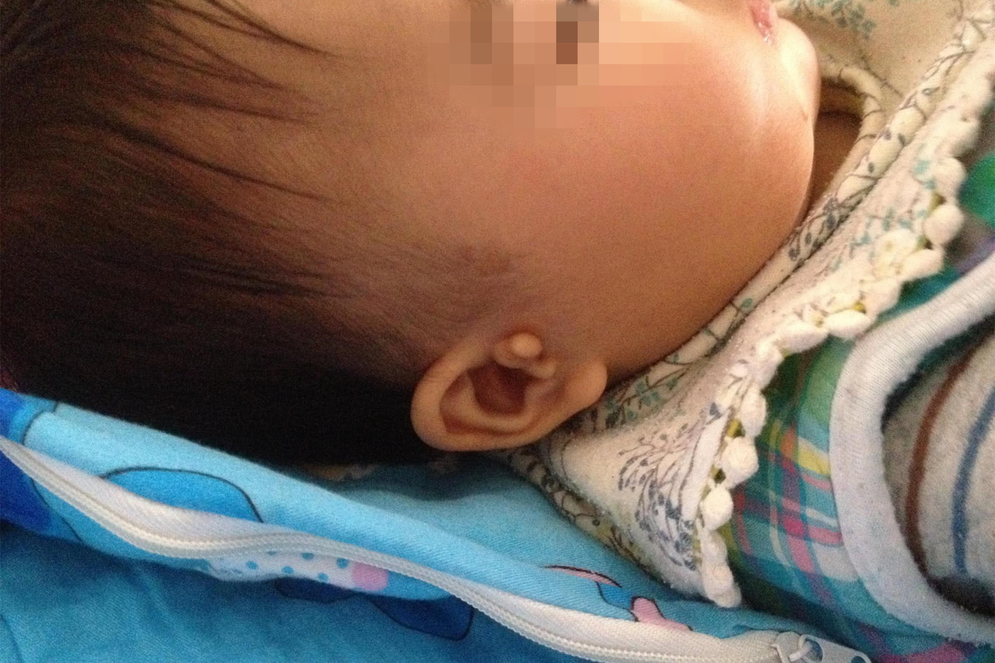 宝宝耳朵上长出肉疙瘩,被称"有福气的拴马桩",原来真相是这样