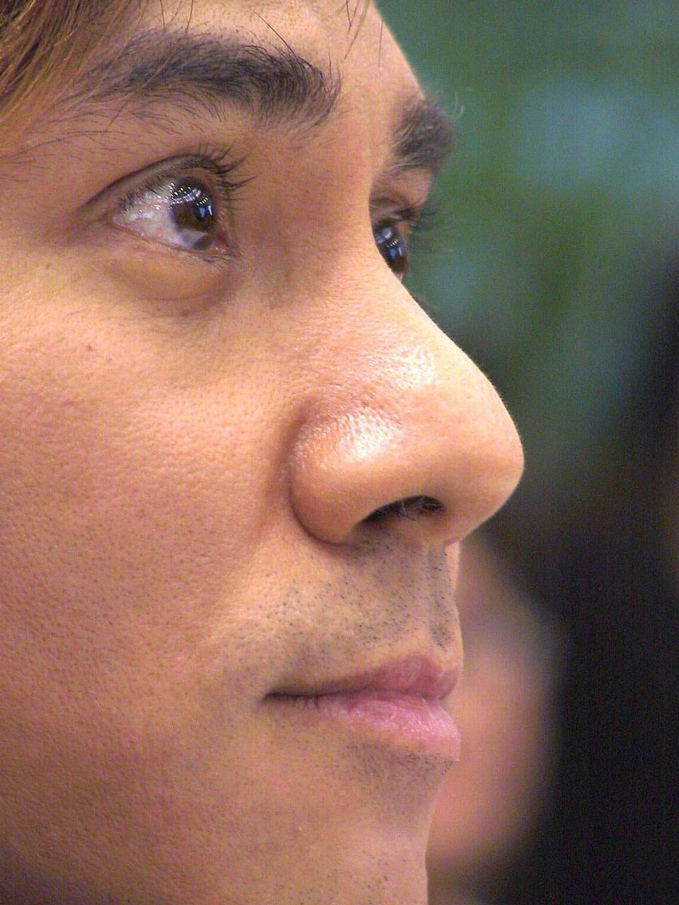 鼻子大鼻翼宽怎么办  鼻子大鼻翼宽的问题可能会给人带来一些困扰