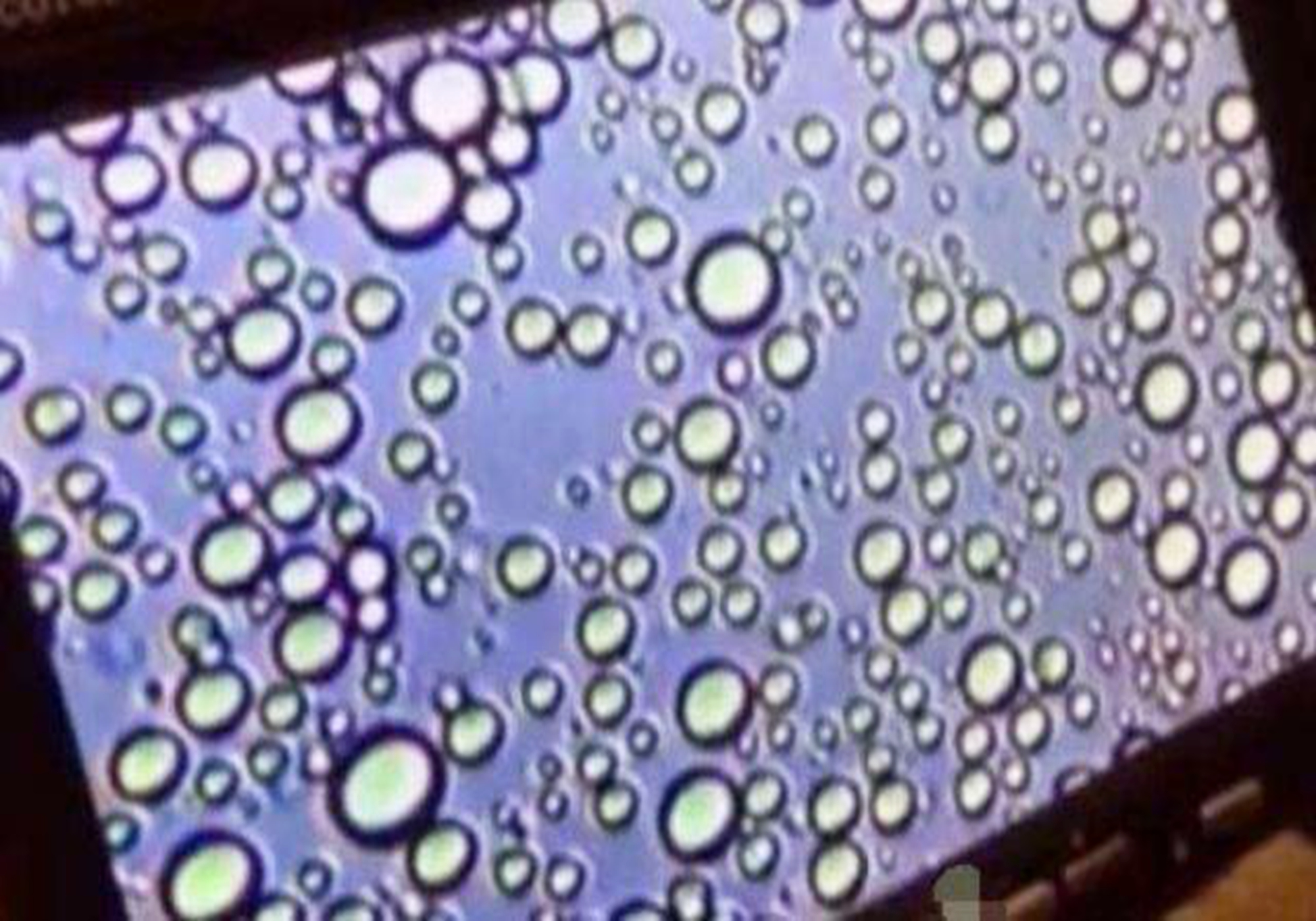 显微镜下的脂肪粒图片