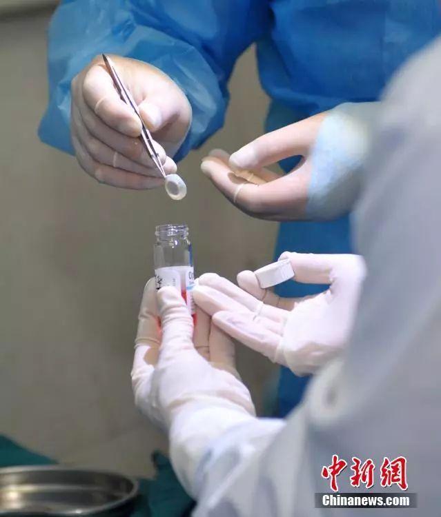 斯里兰卡是世界上最爱捐献眼角膜的国家 来自斯里兰卡的眼角膜遍布