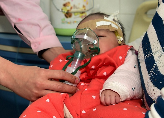 给宝宝做雾化吸入治疗,这些注意事项你必须get√到