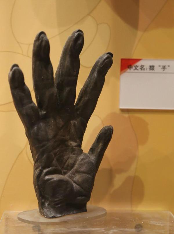 「一看就会考系列」手麻原因找到了,是这根神经损伤