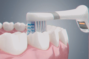 每分钟震动高达30000次,电动牙刷是如何工作的?