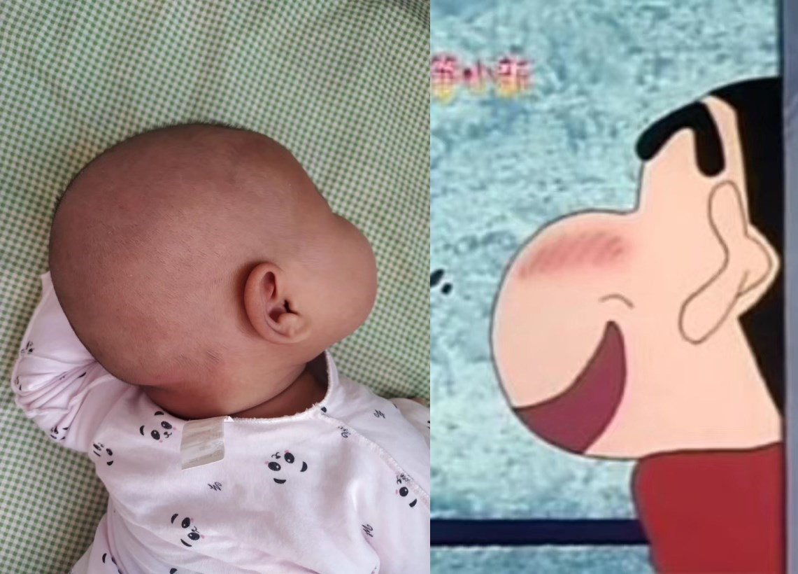 原来"蜡笔小新脸"真实存在,你家孩子是同款吗,网友:动画侧脸