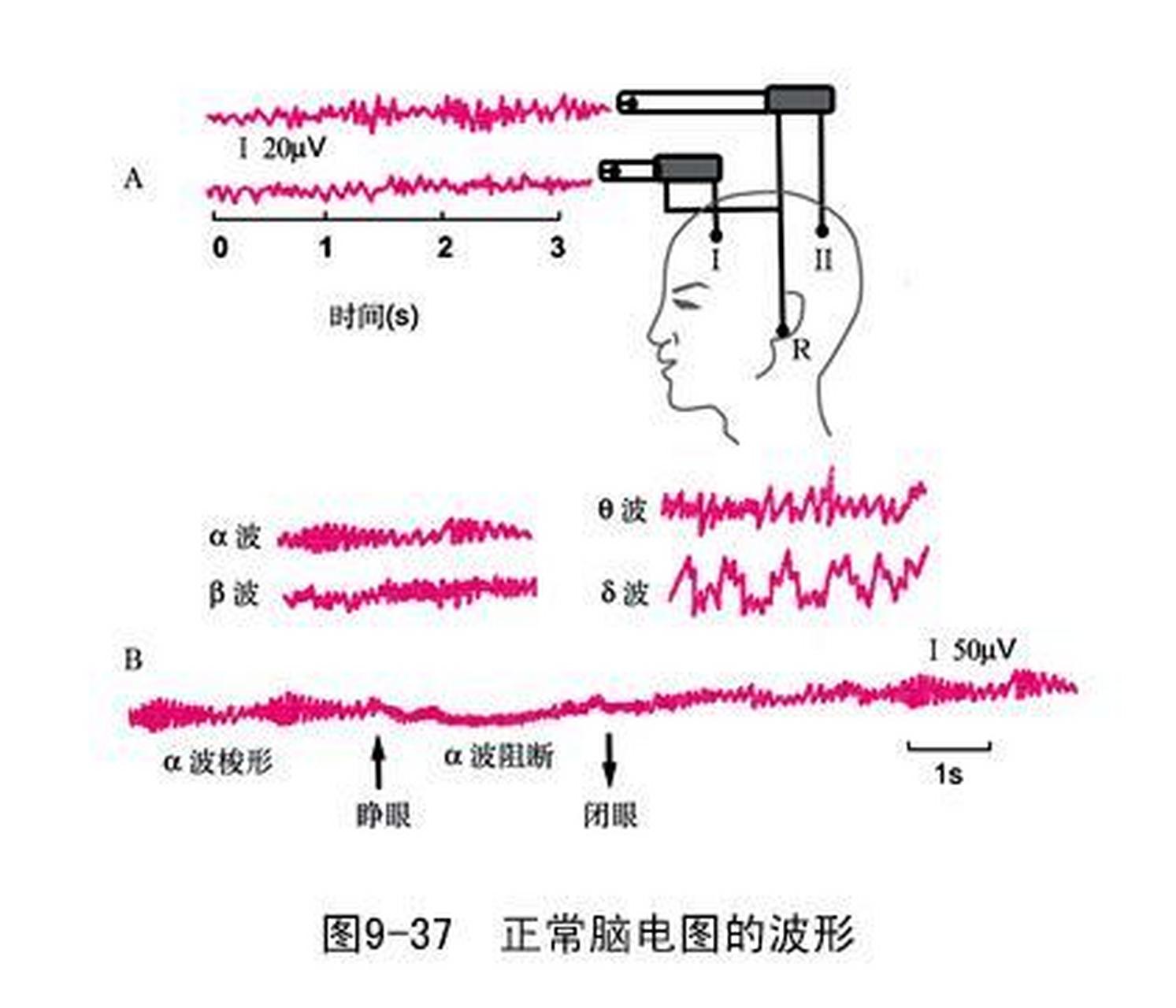 科普知识竞赛#脑电图弥漫性慢波主要是θ波与δ波,在病理状态下,局限