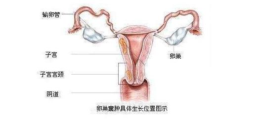 女人的卵巢长什么样图片