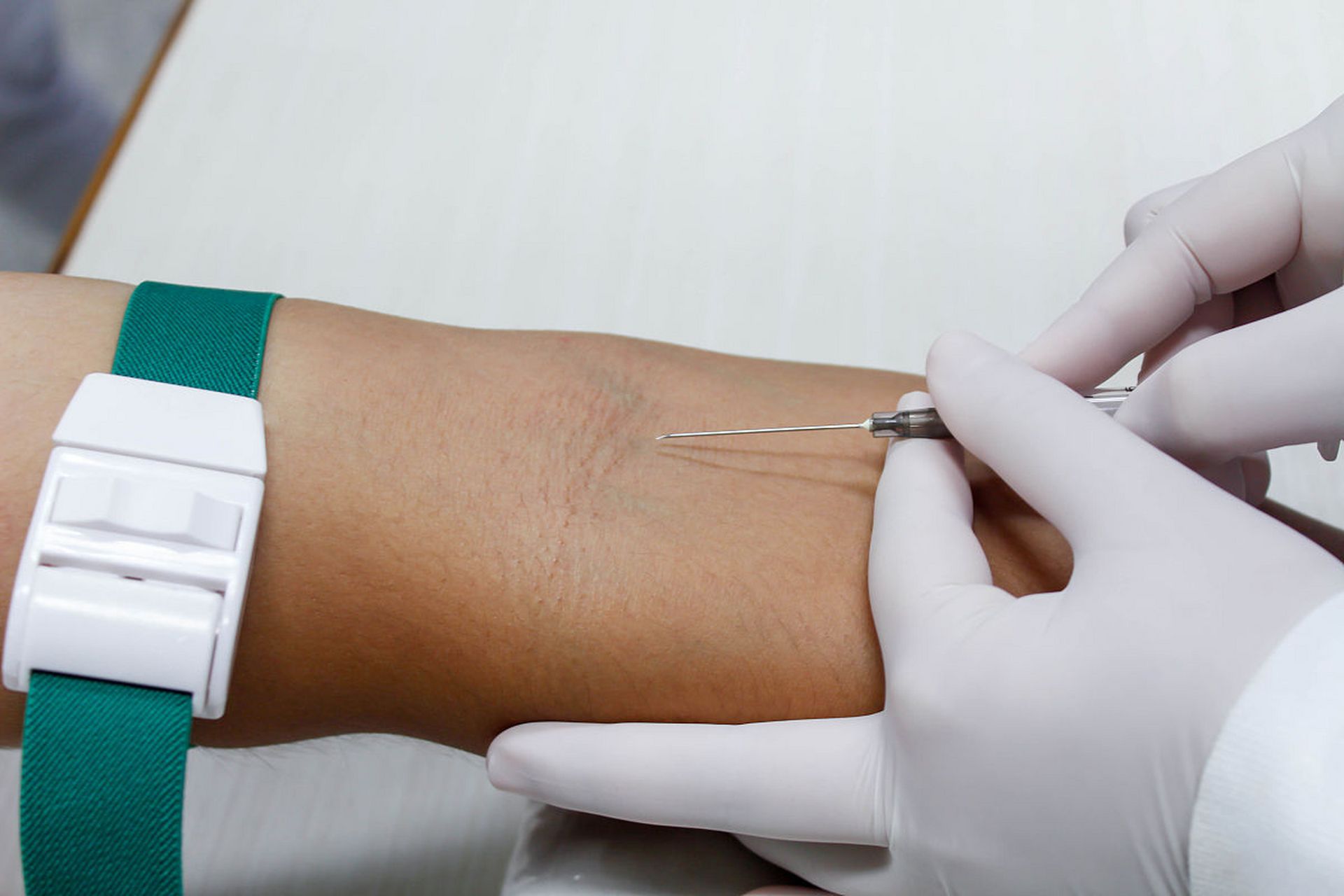 介绍手臂吸脂的三种麻醉方式:  1,局麻手术  顾名思义,只在手术部位