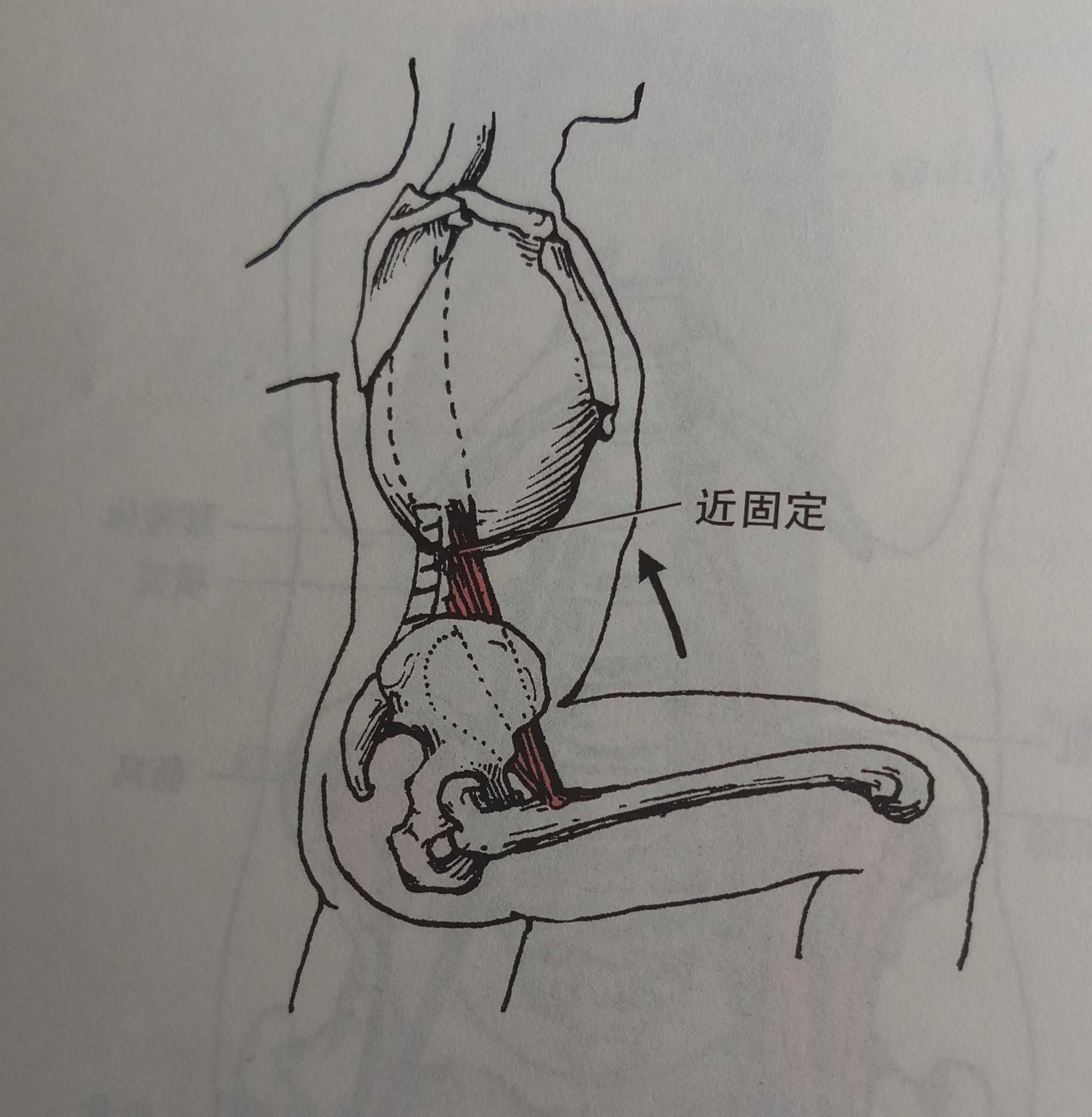 你可能不知道,盲目锻炼腹肌追求马甲线,是你腰疼的主要原因之一