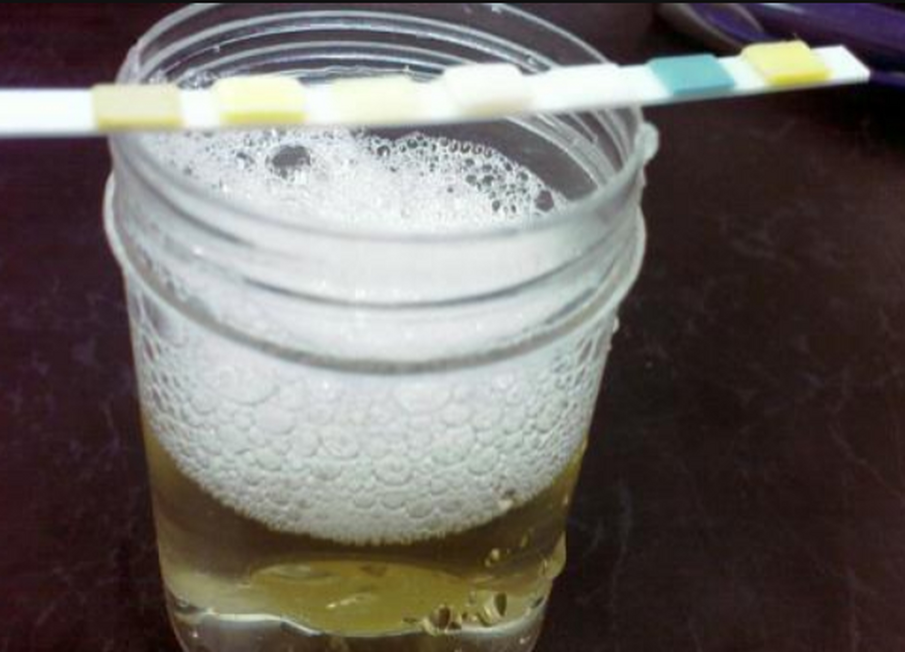 肾强壮男人,晨起"第一泡尿"一般没有这种情况!