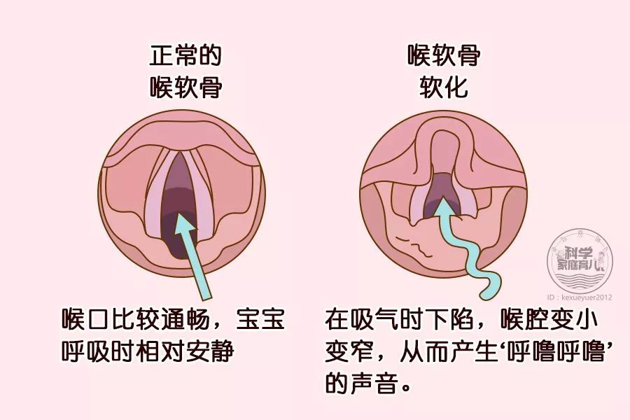 止咳,化痰,霧化,抗生素……寶寶咳嗽咳痰怎麼治最有效?