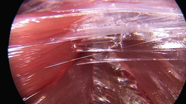 风靡健身圈的筋膜枪究竟值不值得买?