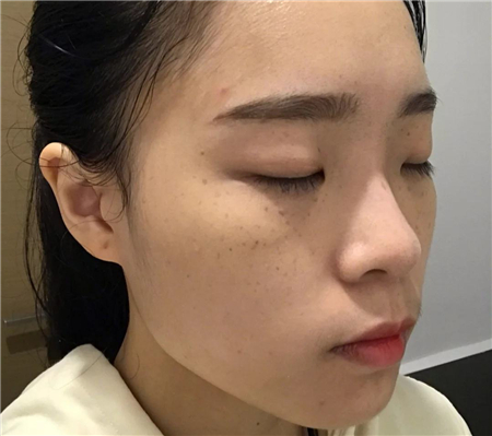 皮肤暗沉有色斑,蜂蜜加它泡茶喝,美白又淡斑,皮肤更嫩白