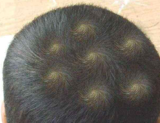 孩子头顶有"2个旋"到底代表啥?多数父母不懂,并非迷信涨知识