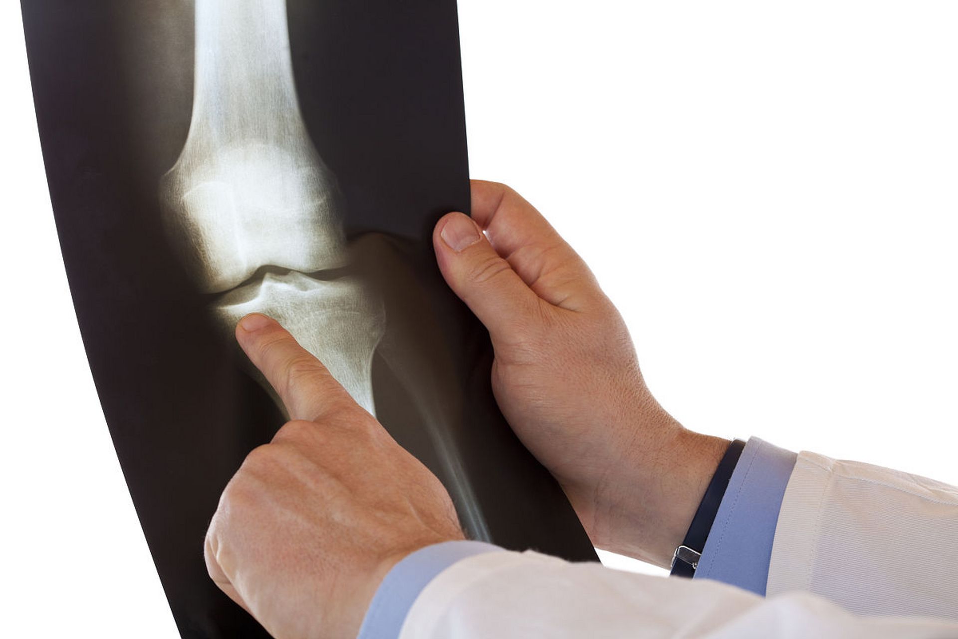 但是,有时候我们会发现膝盖弯曲时会发出咯吱咯吱的响声,这是怎么回事