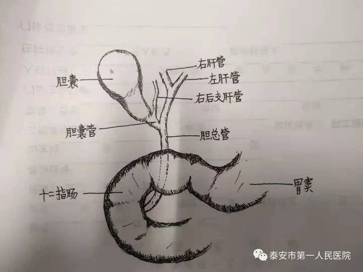 泰安市第一人民医院完成一例胆道解剖异常复杂型胆囊癌手术