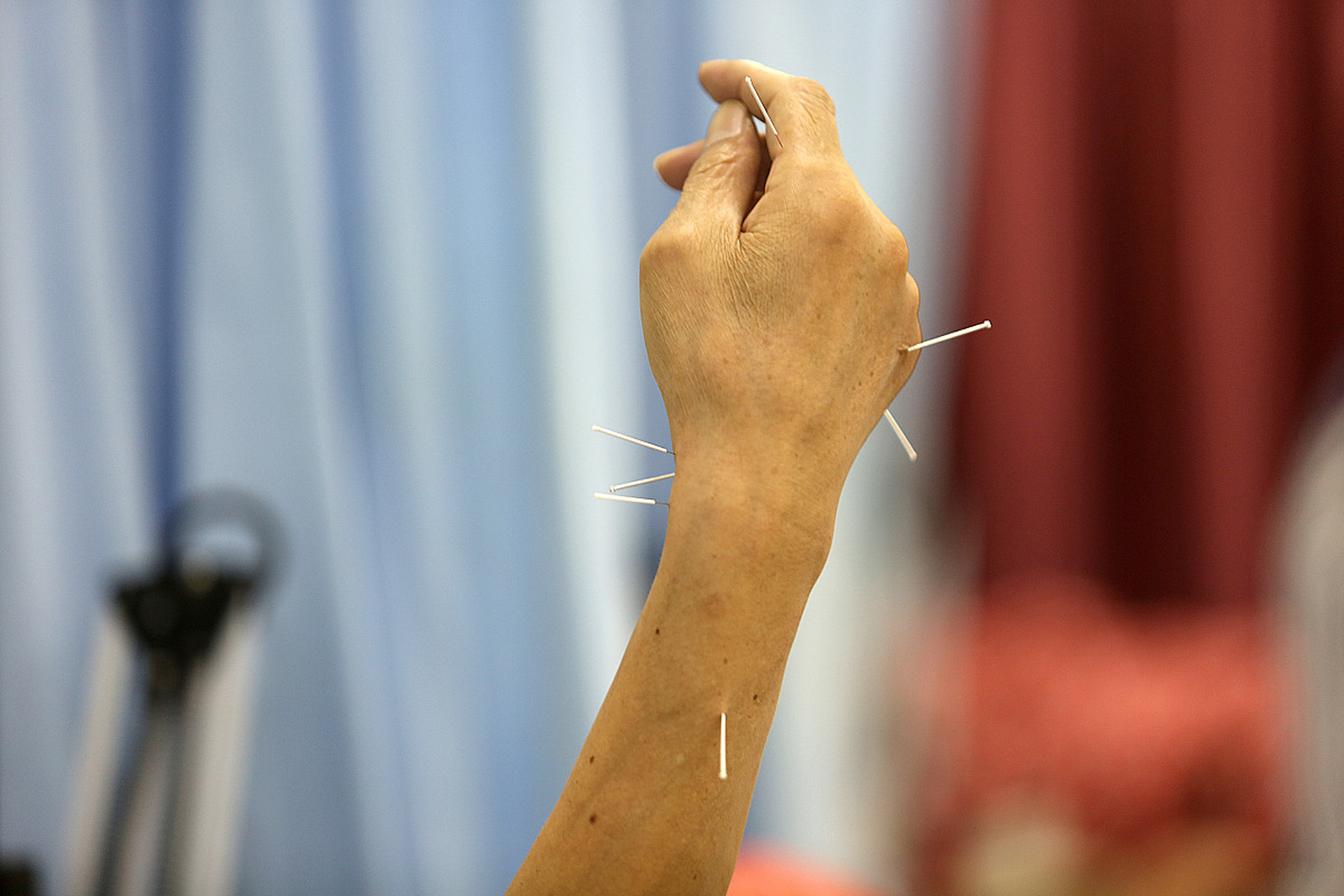 类风湿性关节炎属于中医学痹证范畴,中医认为该病是由于风寒湿热等