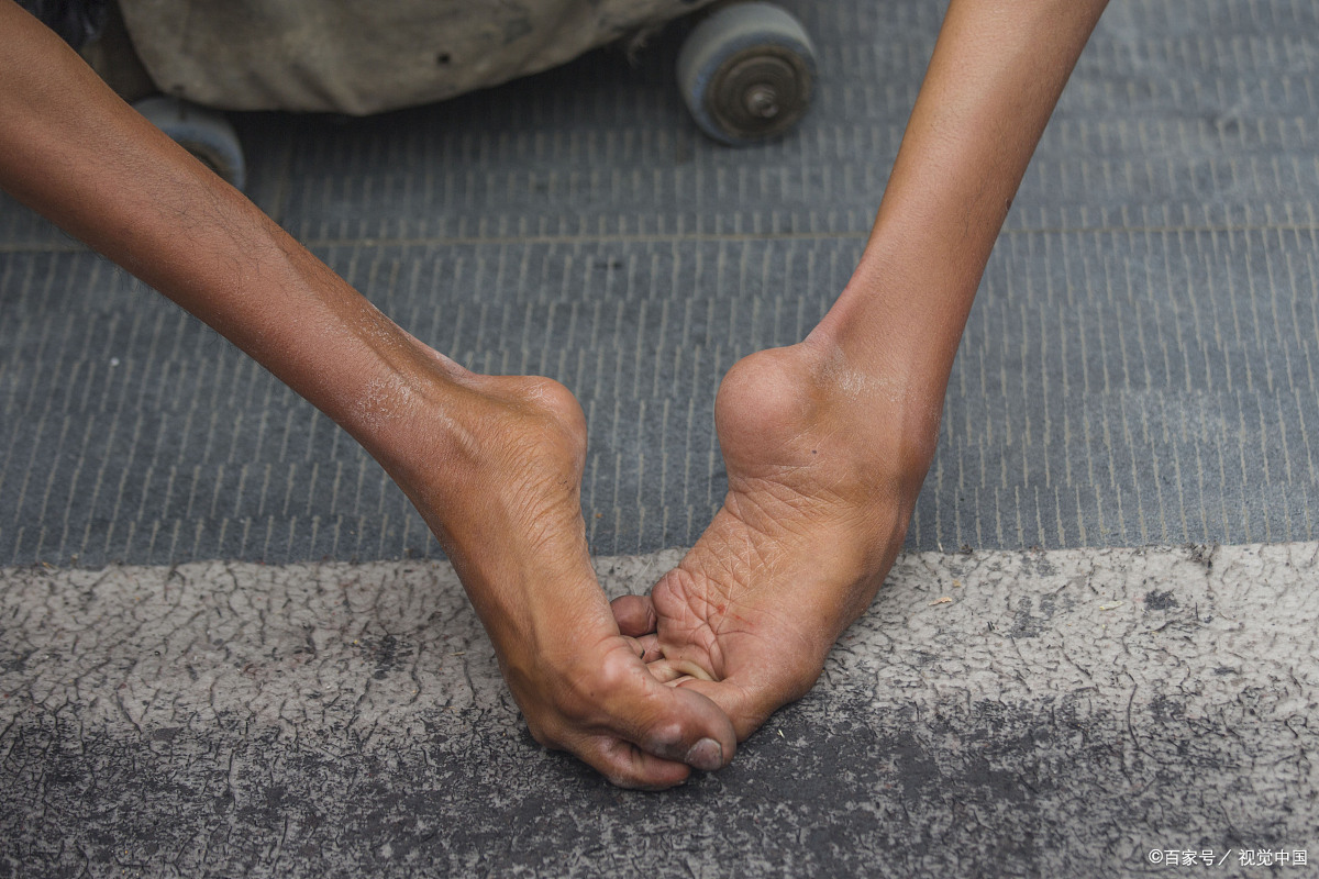 泰国畸形秀有多恐怖