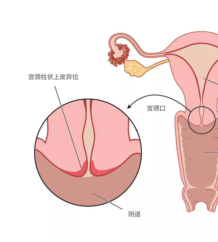 正常的子宫颈图片