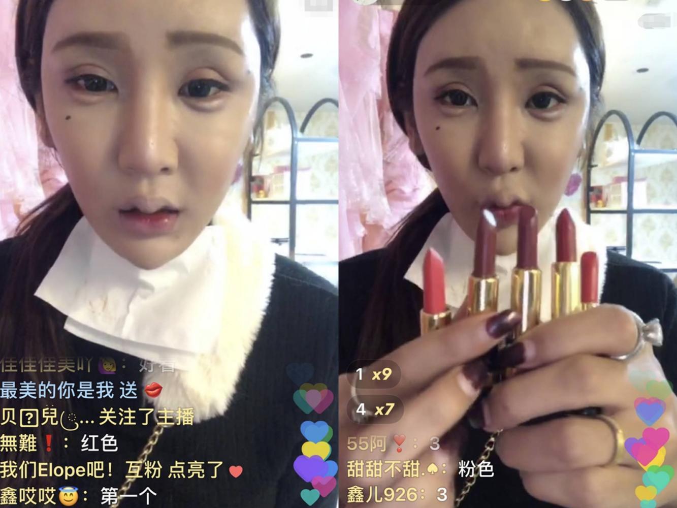 网红"桃花宝宝"沉迷整容,150斤到80斤,网友:真的很有勇气