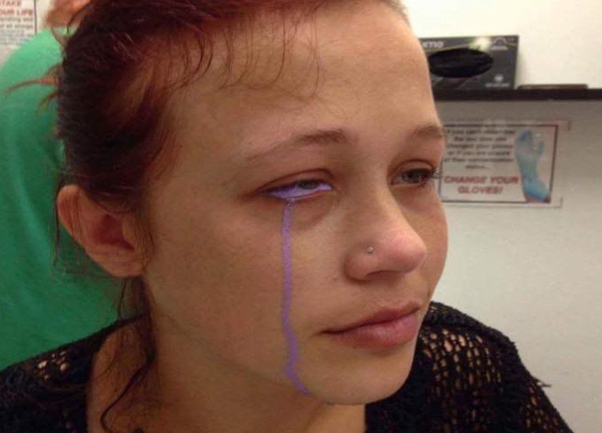 女子"眼球纹身"失败,眼睛变紫色,一度接近失明,碰到灰尘流泪