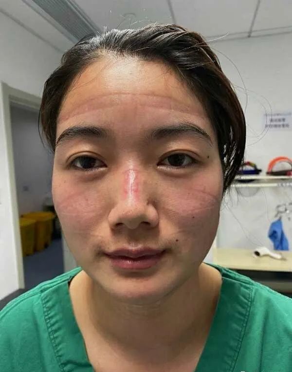 一个退而不休的老人,看到抗疫护士摘掉口罩满脸勒痕,他热泪夺眶