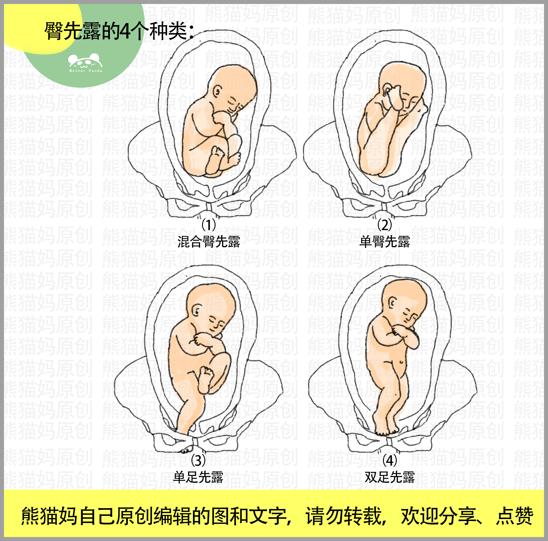 胎位不正11类型图:头先露,臀先露,横产式,斜产式,宝妈