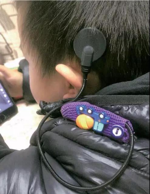 急寻!你见过昆明3岁宝宝的人工耳蜗吗?
