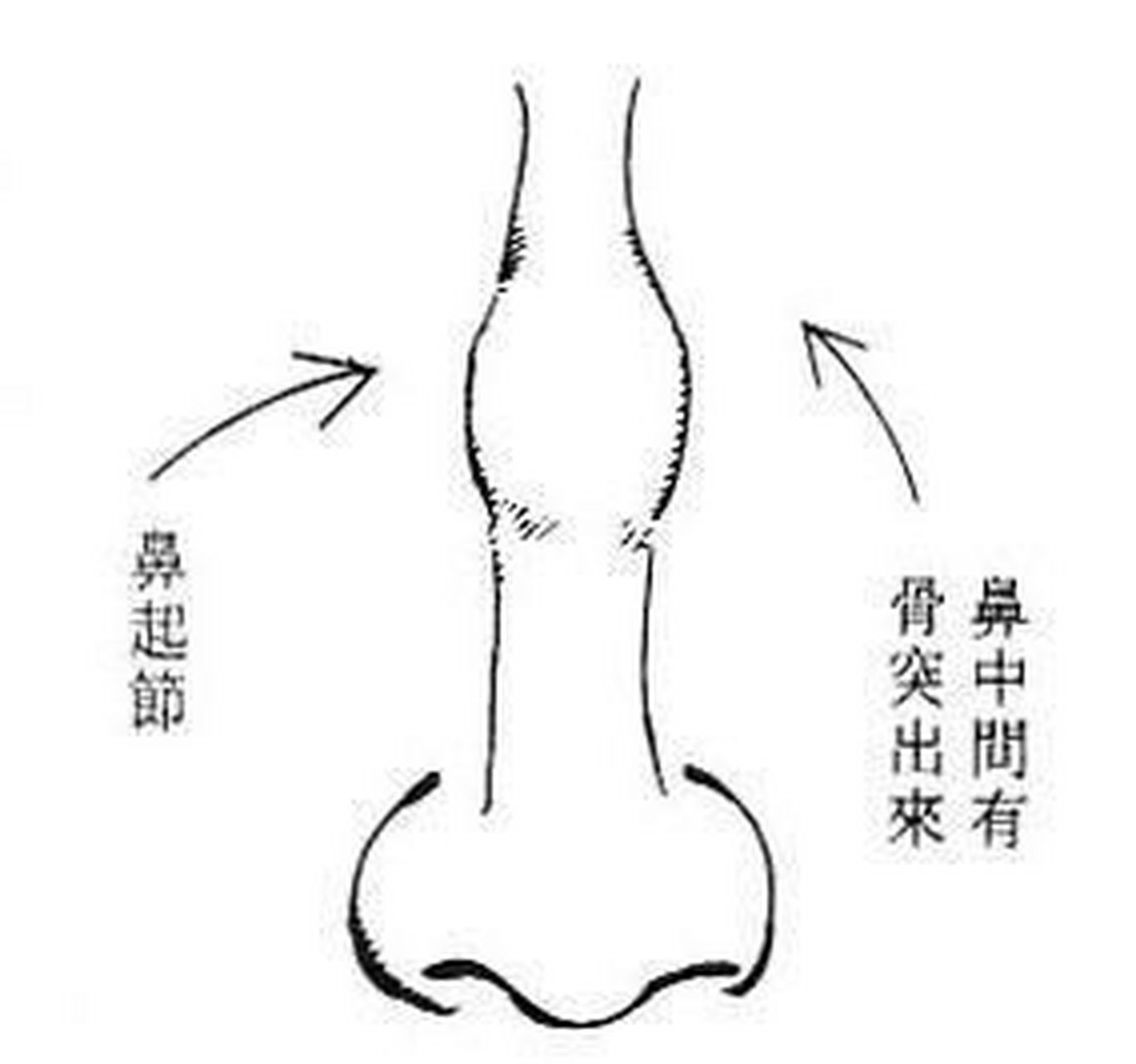 不撞南墙不回头的面相 1,鼻梁起节 鼻梁有节的人,为人自我,做事一根