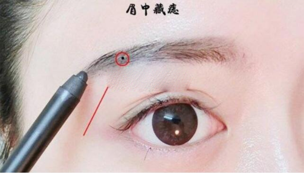 头顶中心长痣自有贵人相助,这些地方也是,你有吗?