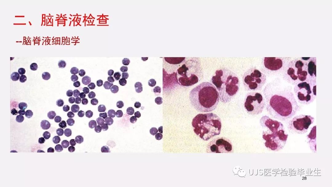 「课件分享」脑脊液检查在神经科疾病诊断中的应用