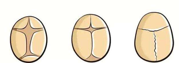 囟门闭合过早和大脑发育的关系,三种结果,第三种影响大脑发育