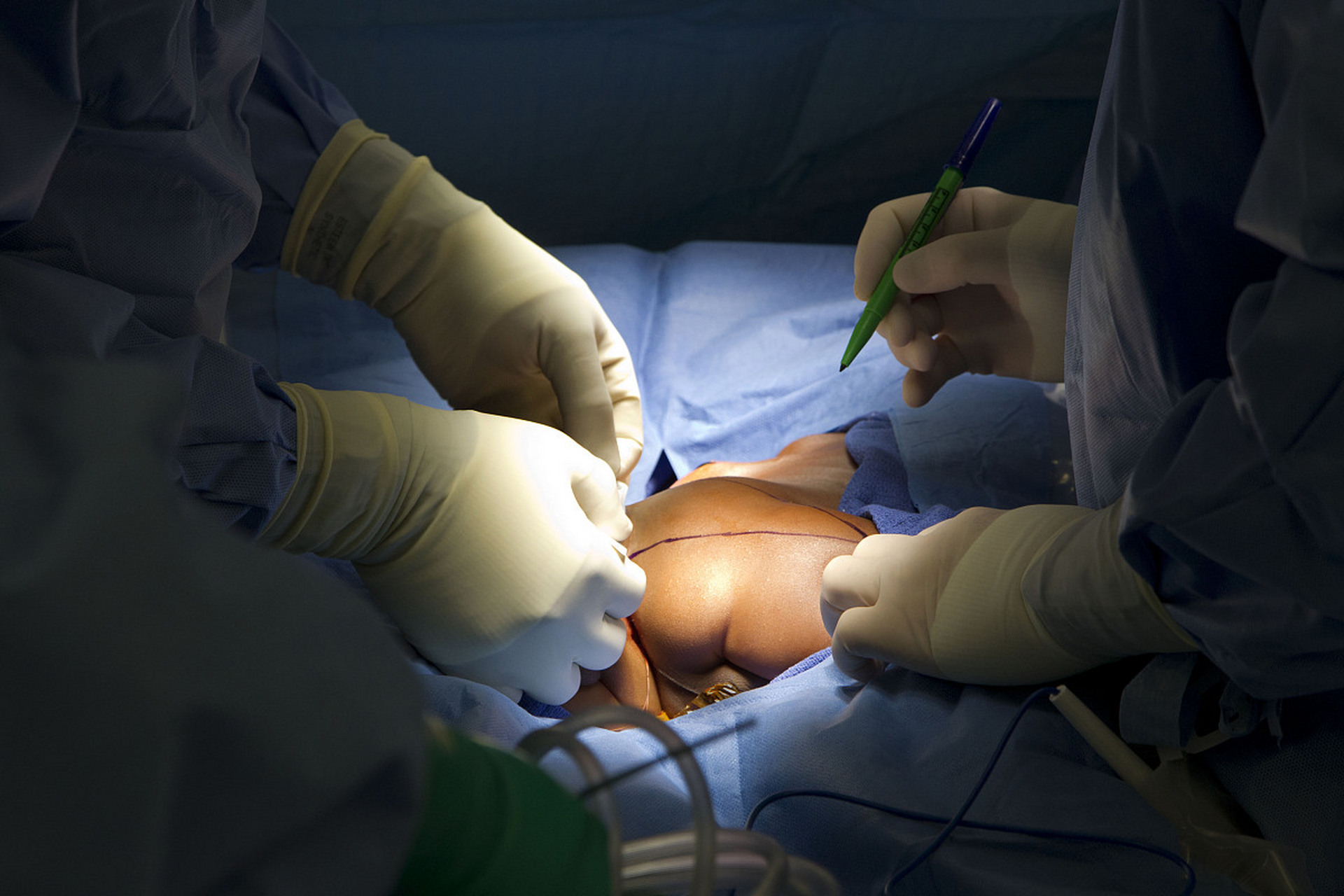 孩子的家属认为医院有责任,要求进行尸检.