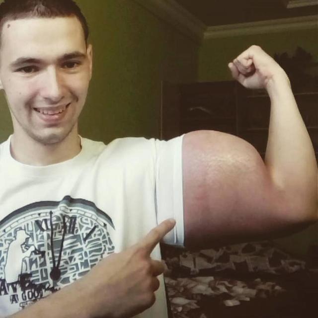 俄罗斯男子拥有一双麒麟臂,手臂粗60cm,快要爆炸了!