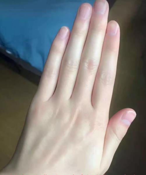 王凯这双手是做过"美甲"吧?细长又白皙水嫩,越看越眼红