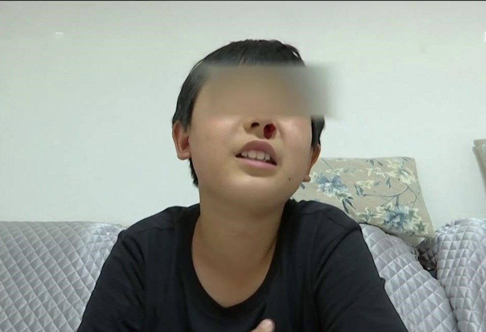 一上学就呕吐!初中生成绩下滑内心焦虑得"怪病"