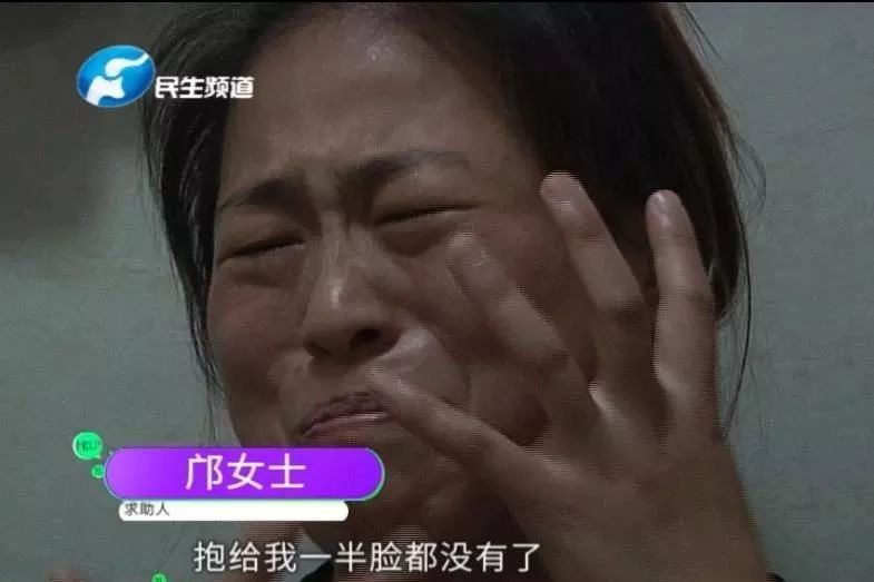河南周口13个月大孩子被咬掉半边脸,狗主人愿筹钱看病
