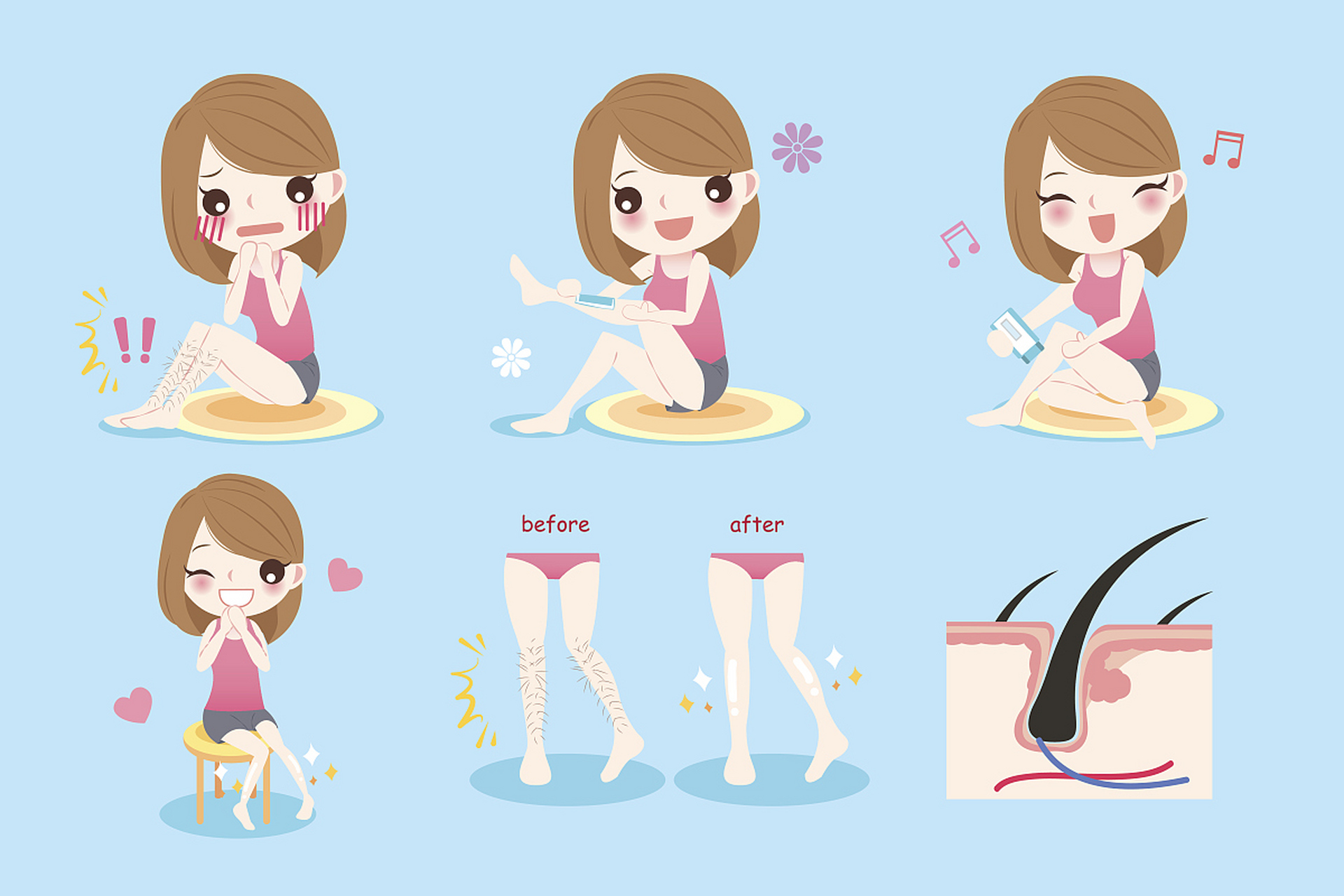 剃刀除毛:使用剃刀刮除体表的毛发.