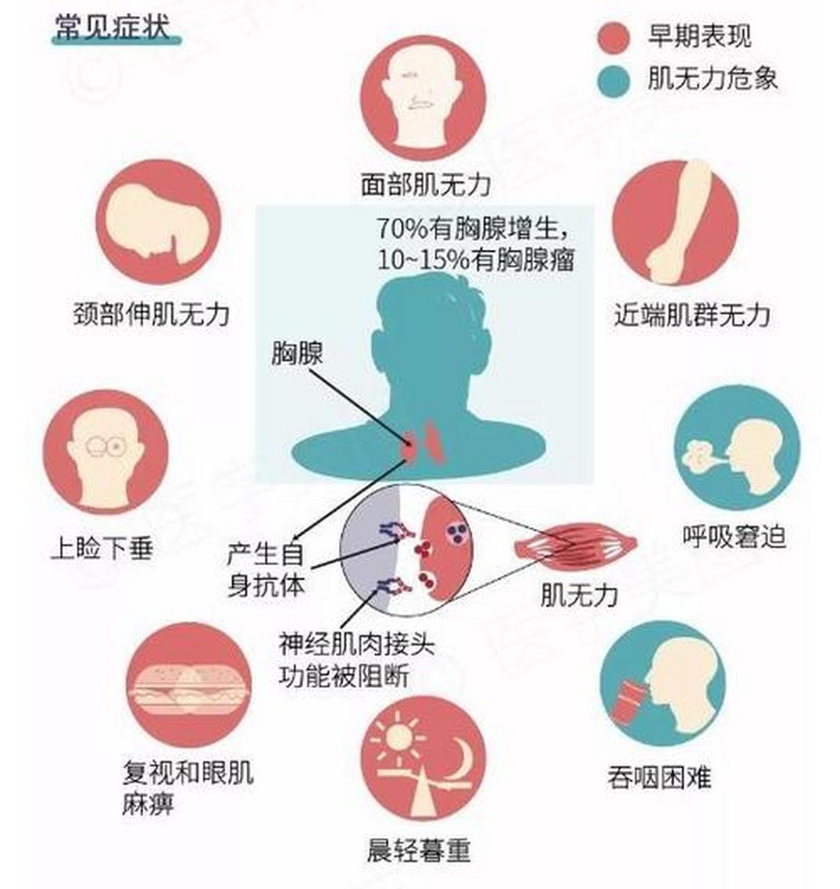 科普知识竞赛#新斯的明试验是诊断重症肌无力(mg)