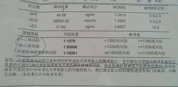 唐氏综合症寿命图片