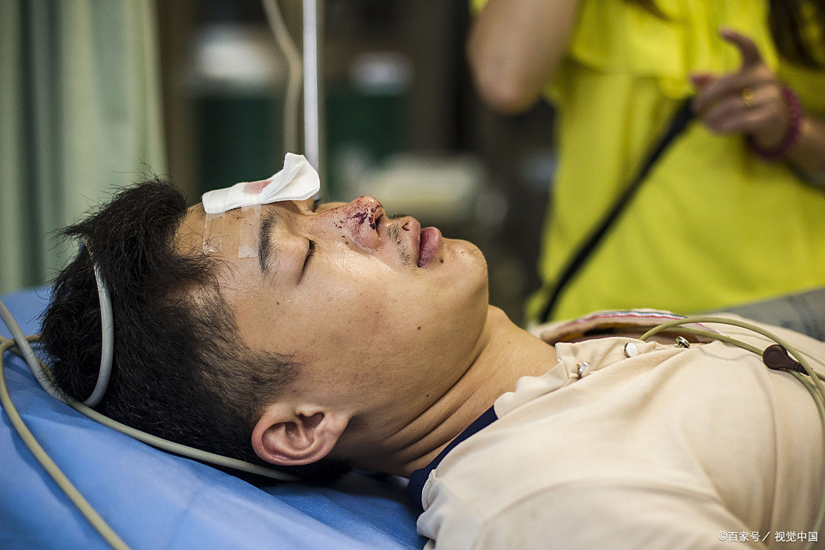 颅脑外伤是一种常见的头部损伤,通常由交通事故,跌倒,工伤事故等引起