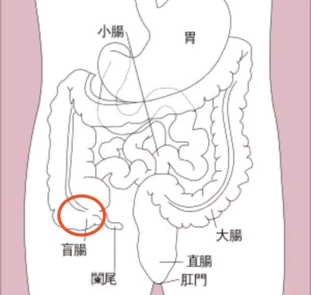 阑尾炎的位置 女性图片