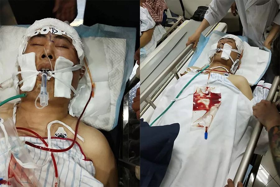 一场车祸,外卖小哥倒在了血泊中,妻子朋友圈求助